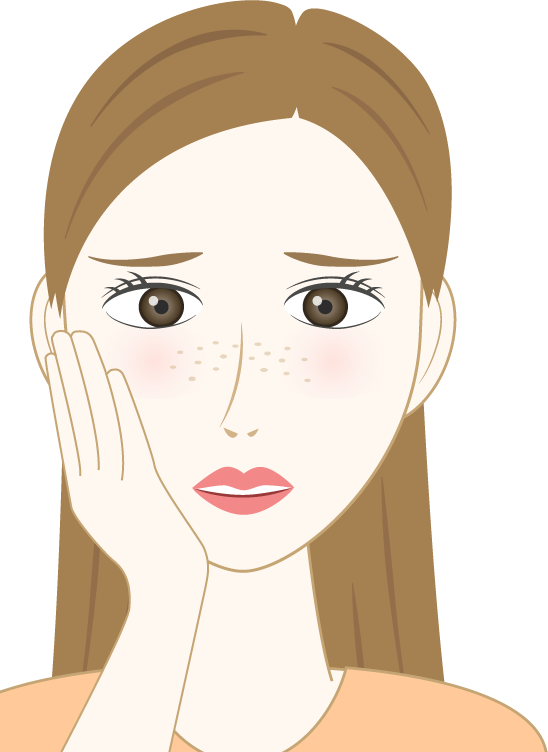 肌トラブル（そばかす）のフリー素材